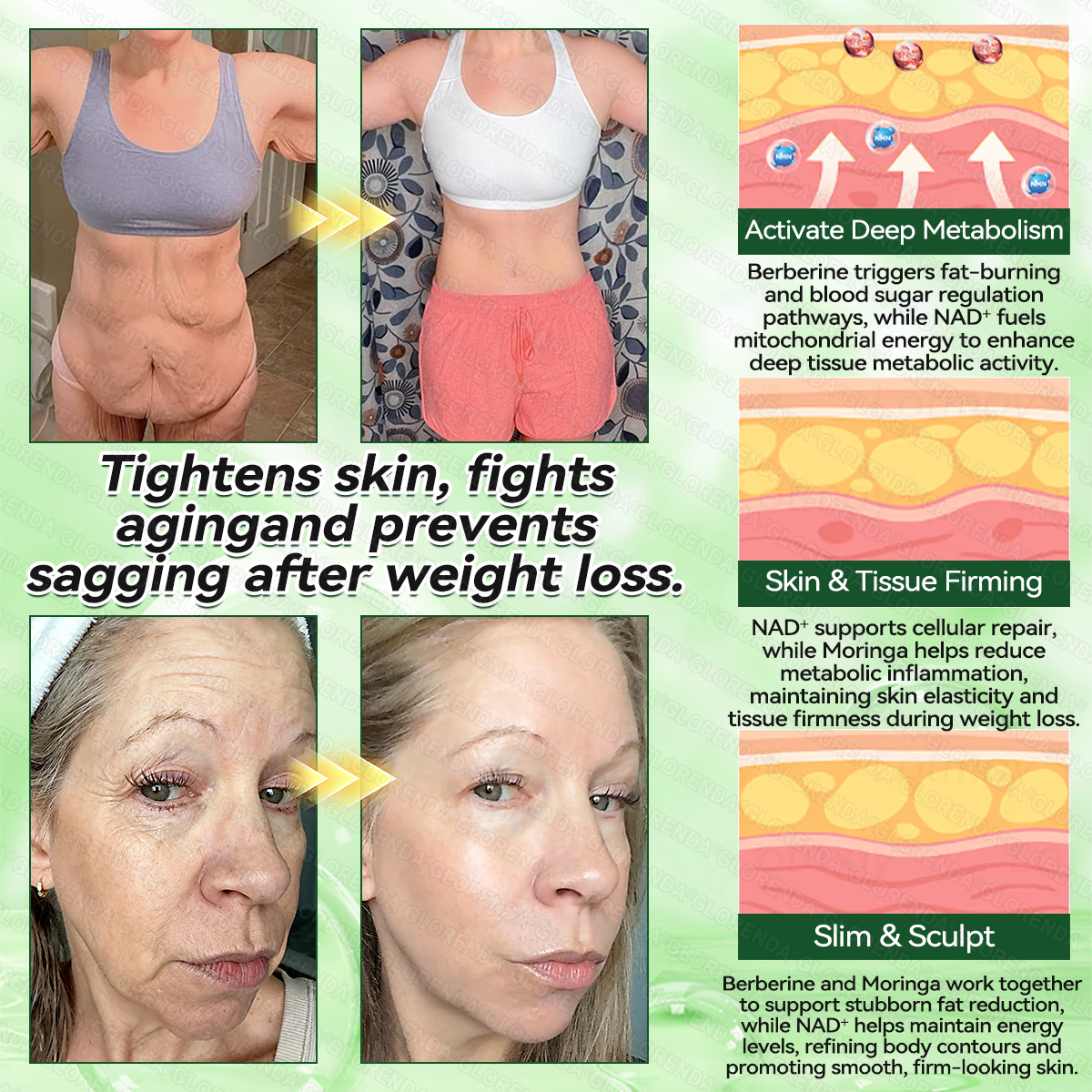 Skin Tightening