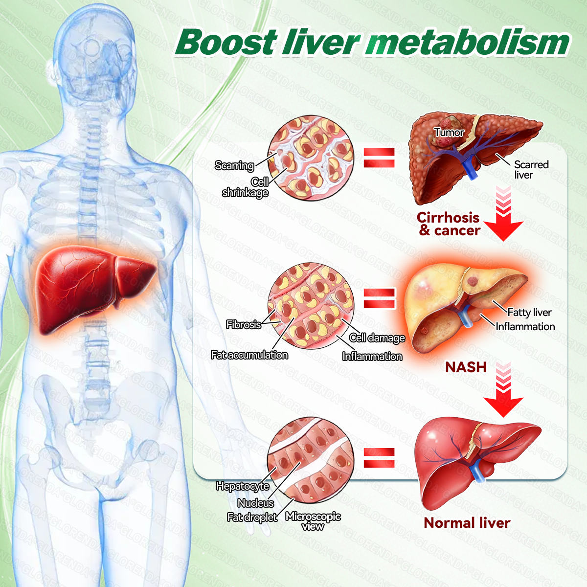 Liver Support